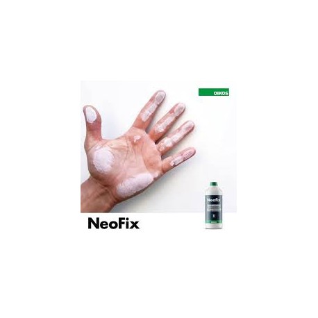 Neofix